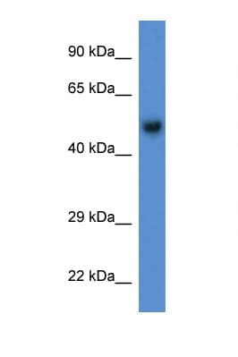 BAR / BFAR Antibody (aa110-159)