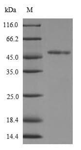 Human FGFR3 Protein (Recombinant 6His, N-terminus)