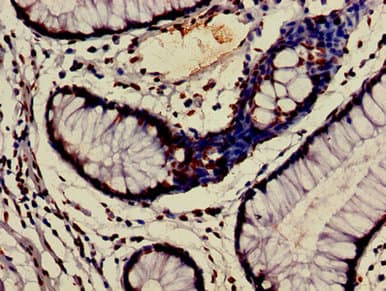 Polyclonal Rabbit anti-Human HIST1H3A Antibody (IHC, IF, WB)