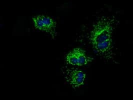 ATP5B / ATP Synthase Beta Antibody (clone OTI1B10)