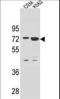 ZNF324 / ZF5128 Antibody (aa507-535)