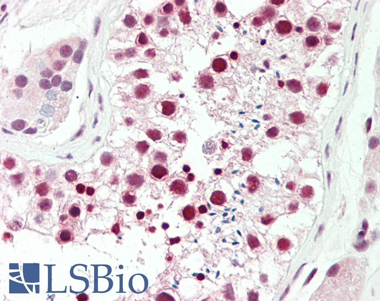 IHC-plus™ DDX39 Antibody