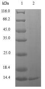 Human RFC1 / RFC Protein (Recombinant 10His, N-terminus + Myc, C-terminus)