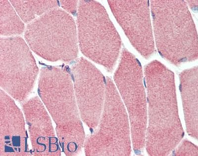 IHC-plus™ MAP2K5 / MEK5 Antibody