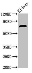 Polyclonal Rabbit anti-Human ZBTB16 / PLZF Antibody (WB)