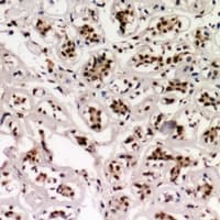 CNOT8 Antibody
