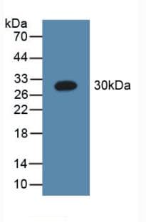 Complement C1QA Antibody (aa28-245, APC)