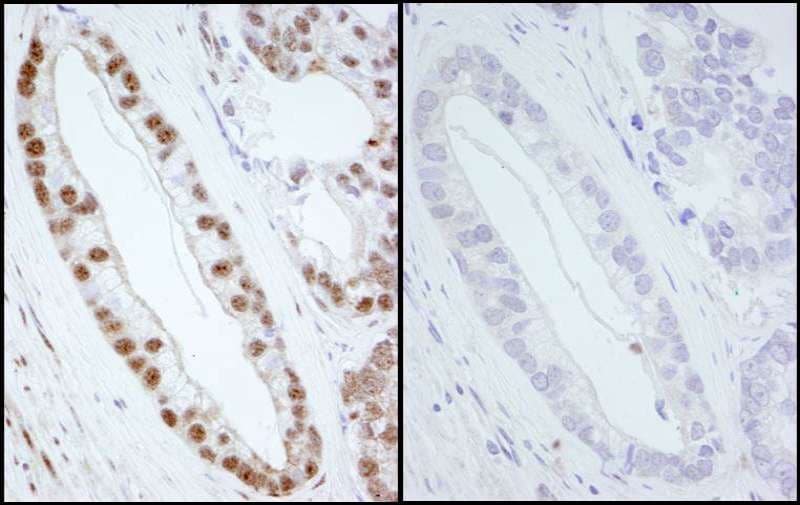SMC1A / SMC1 Antibody (phospho-Ser966)