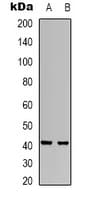 RRS1 Antibody (Internal)