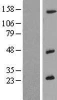 IL26 Protein (Over-Expression Lysate Myc-DDK (Flag))