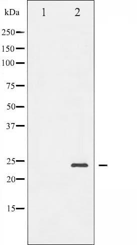 Polyclonal Rabbit anti-Human BAD Antibody (phospho-Ser155, IHC, IF, WB)