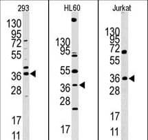 Polyclonal Rabbit anti-Human HIF1AN Antibody (aa23-54, WB)