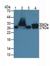 TNNI1 Antibody (aa1-187)