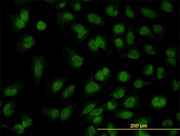FOXR2 Antibody (clone 2C1)