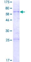 Human C6orf81 Protein (Recombinant GST)