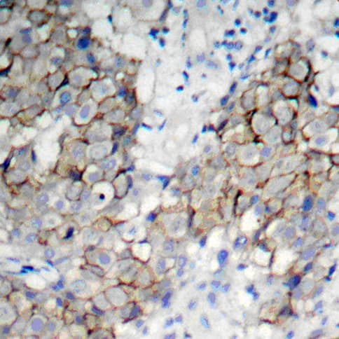 IGF1R / IGF1 Receptor Antibody (phospho-Tyr1161)