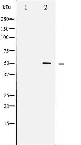 Polyclonal Rabbit anti-Human MYC / c-Myc Antibody (phospho-Ser62, IHC, IF, WB)