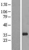 ZNF80 Protein (Over-Expression Lysate Myc-DDK (Flag))