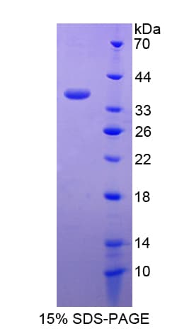 Human MUCL1 Protein (Recombinant His-GST)
