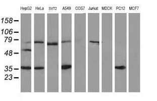 IHC-plus™ VASP Antibody (clone 4D6)