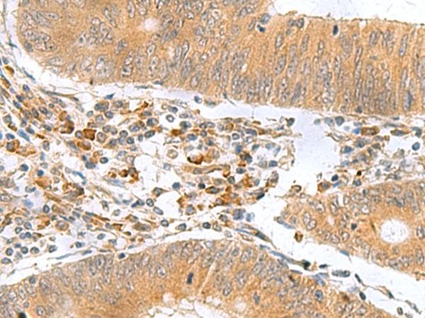 Polyclonal Rabbit anti-Human MYDGF / SF20 Antibody (IHC)