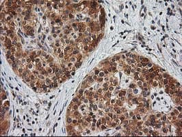 MAPRE2 / EB2 Antibody (clone OTI7A2)