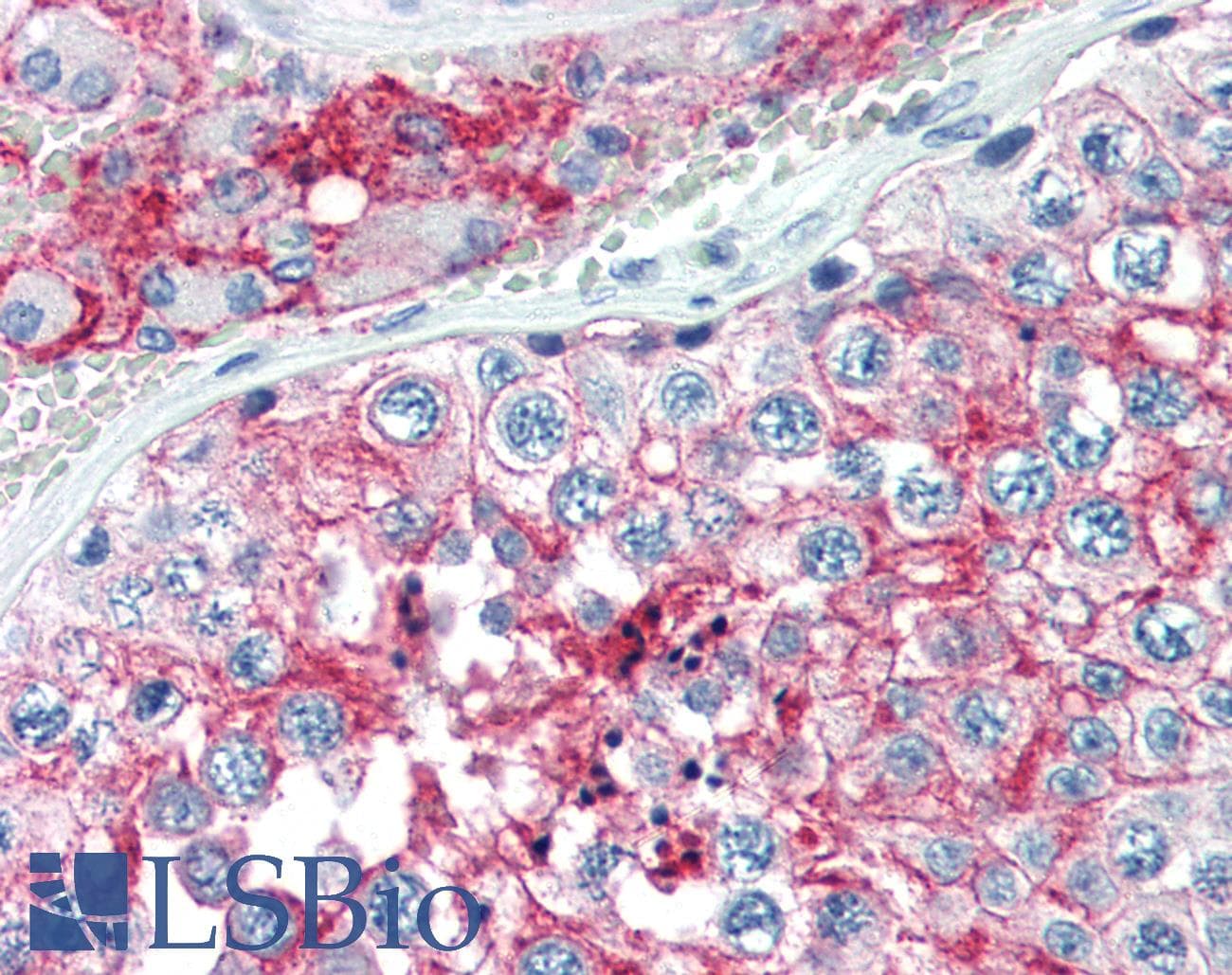 IHC-plus™ Monoclonal Mouse anti-Human Basigin / Emmprin / CD147 Antibody (clone MEM-M6/6, Azide-free, IHC)