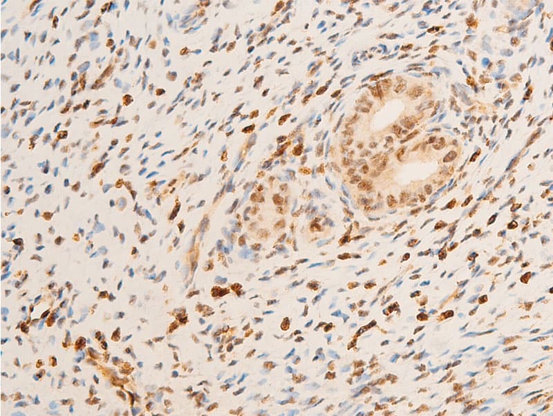Polyclonal Rabbit anti-Human NTRK1 / TrkA Antibody (phospho-Tyr680,phospho-Tyr681, IHC, WB)