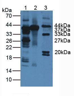 ARG1 / Arginase 1 Antibody (aa1-322, PE)