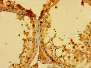 GCET2 / HGAL Antibody