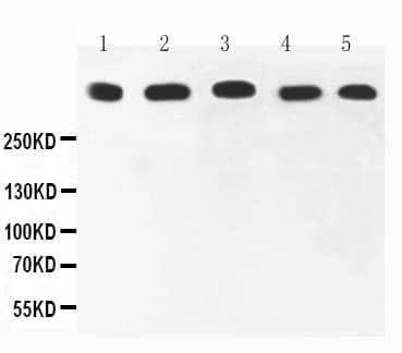 MKI67 / Ki67 Antibody (aa2860-3256)