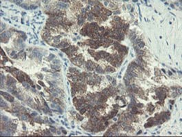 DOK7 Antibody (clone OTI1D11)