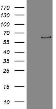 FSCN1 / Fascin Antibody (clone OTI5G1)