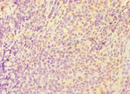 CASP6 / Caspase 6 Antibody (aa24-293)