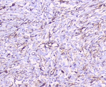 CD32A Antibody