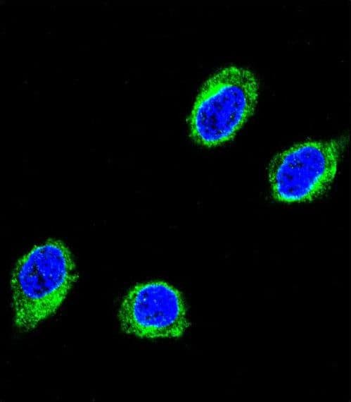 Polyclonal Rabbit anti-Human CCHCR1 Antibody (aa599-627, IHC, IF, WB)