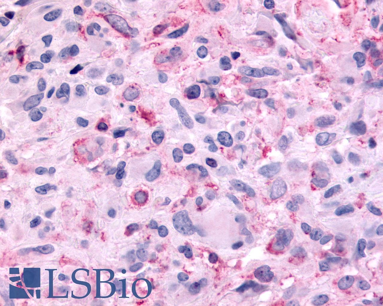 PathPlus™ Polyclonal Rabbit anti-Human MTNR1B / MT2 Antibody (Extracellular Domain, IHC)