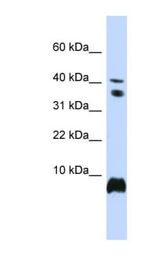 Polyclonal Rabbit anti-Human HMGN1 / HMG14 Antibody (aa36-85, IHC, WB)