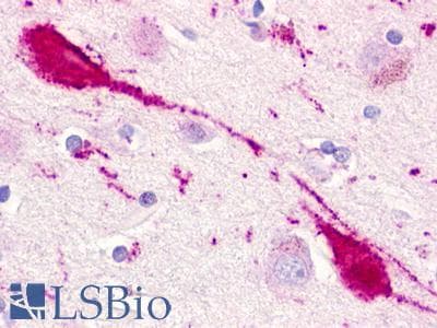PathPlus™ CHEMR23 / CMKLR1 Antibody (N-Terminus)