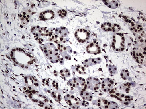 HNRNPL / hnRNP L Antibody (aa270-502, clone OTI9G7, Carrier-free)