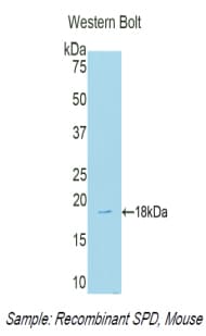 SFTPD / Surfactant Protein D Antibody (aa45-221, APC)
