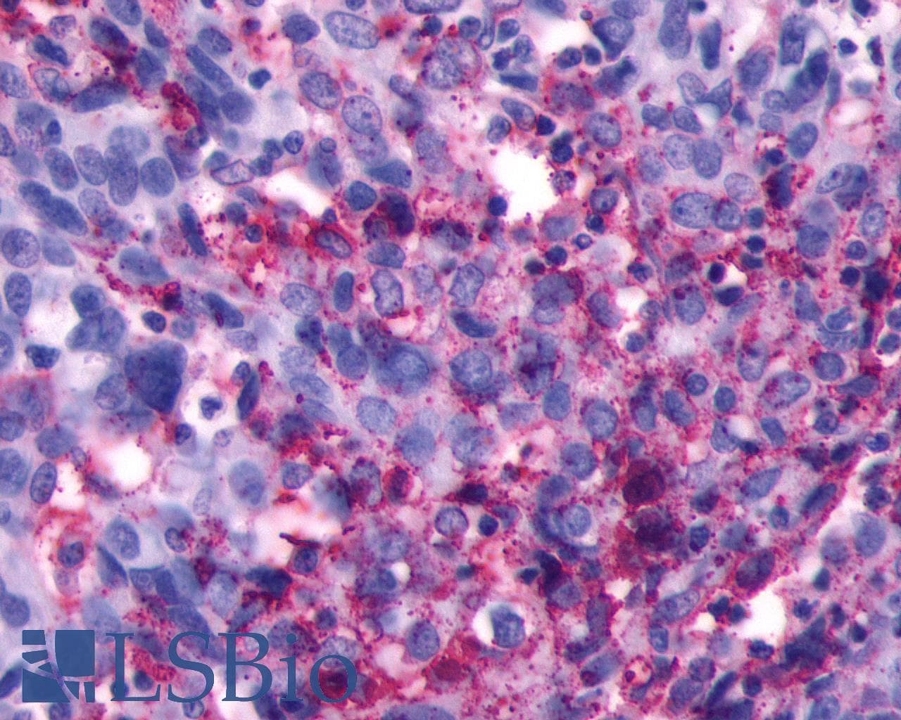 PathPlus™ LHCGR / LHR / LH Receptor Antibody (C-Terminus)