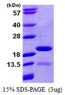 Human PIN4 Protein (Recombinant His)