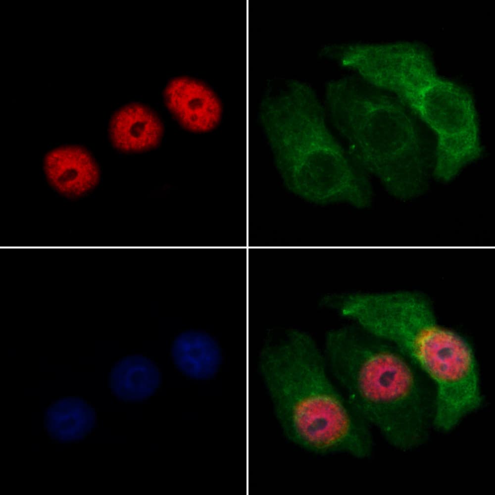 Polyclonal Rabbit anti-Human ZNF238 Antibody (IF, WB)