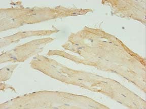 Polyclonal Rabbit anti-Human STX10 / Syntaxin 10 Antibody (IHC)