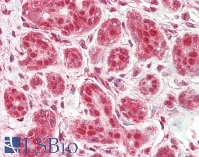 IHC-plus™ Polyclonal Rabbit anti-Human PSMC3 Antibody (aa339-389, IHC, WB)