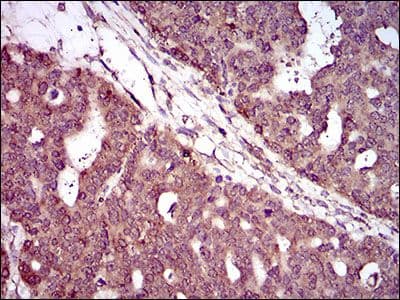 HIWI2 / PIWIL4 Antibody (Amino Acid: 304-434, clone 10G9B11)
