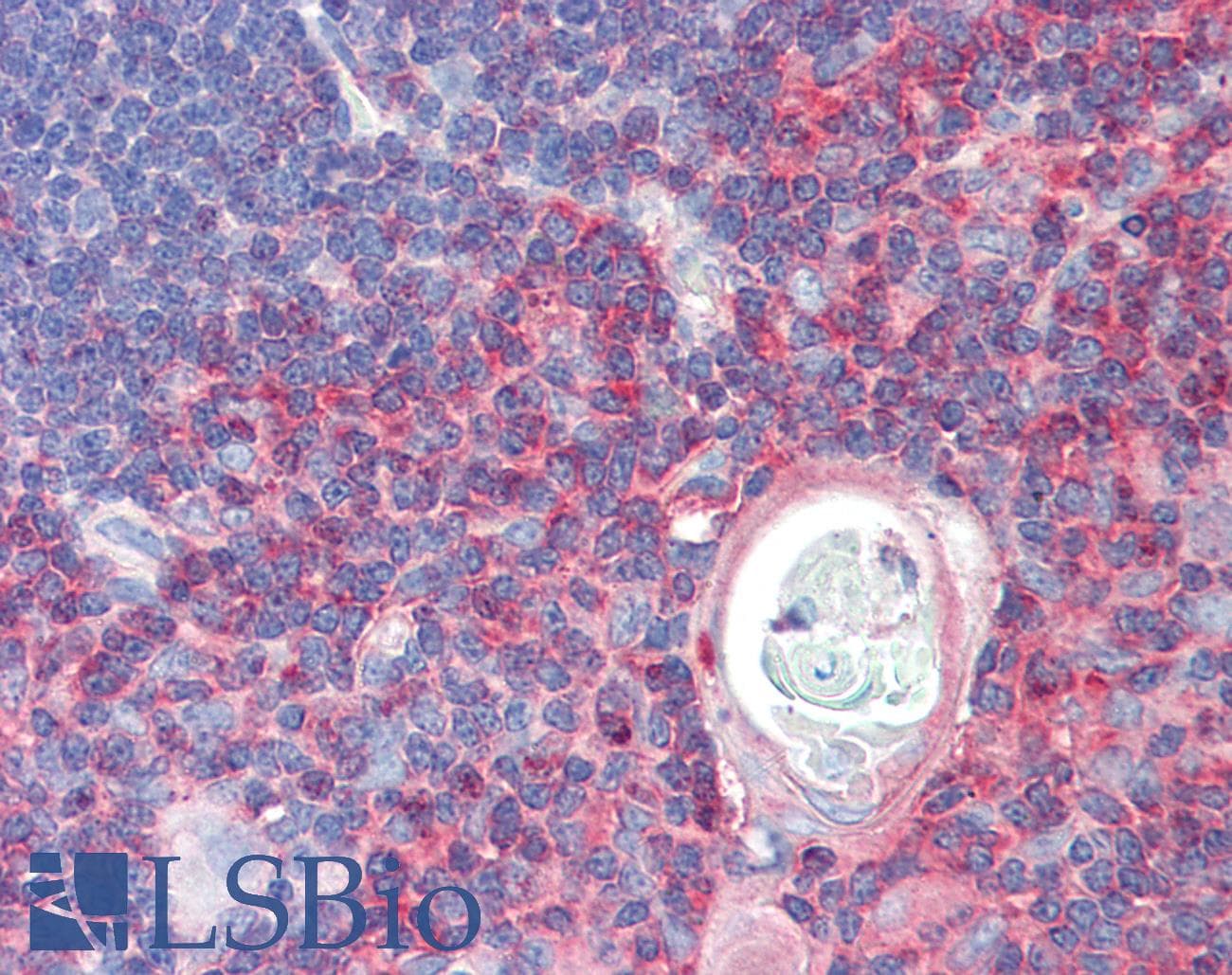 IHC-plus™ TXK / RLK Antibody (aa515-527)