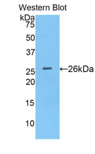 HPX / Hemopexin Antibody (aa31-242)