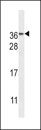 IHC-plus™ NMNAT3 Antibody (aa150-178)